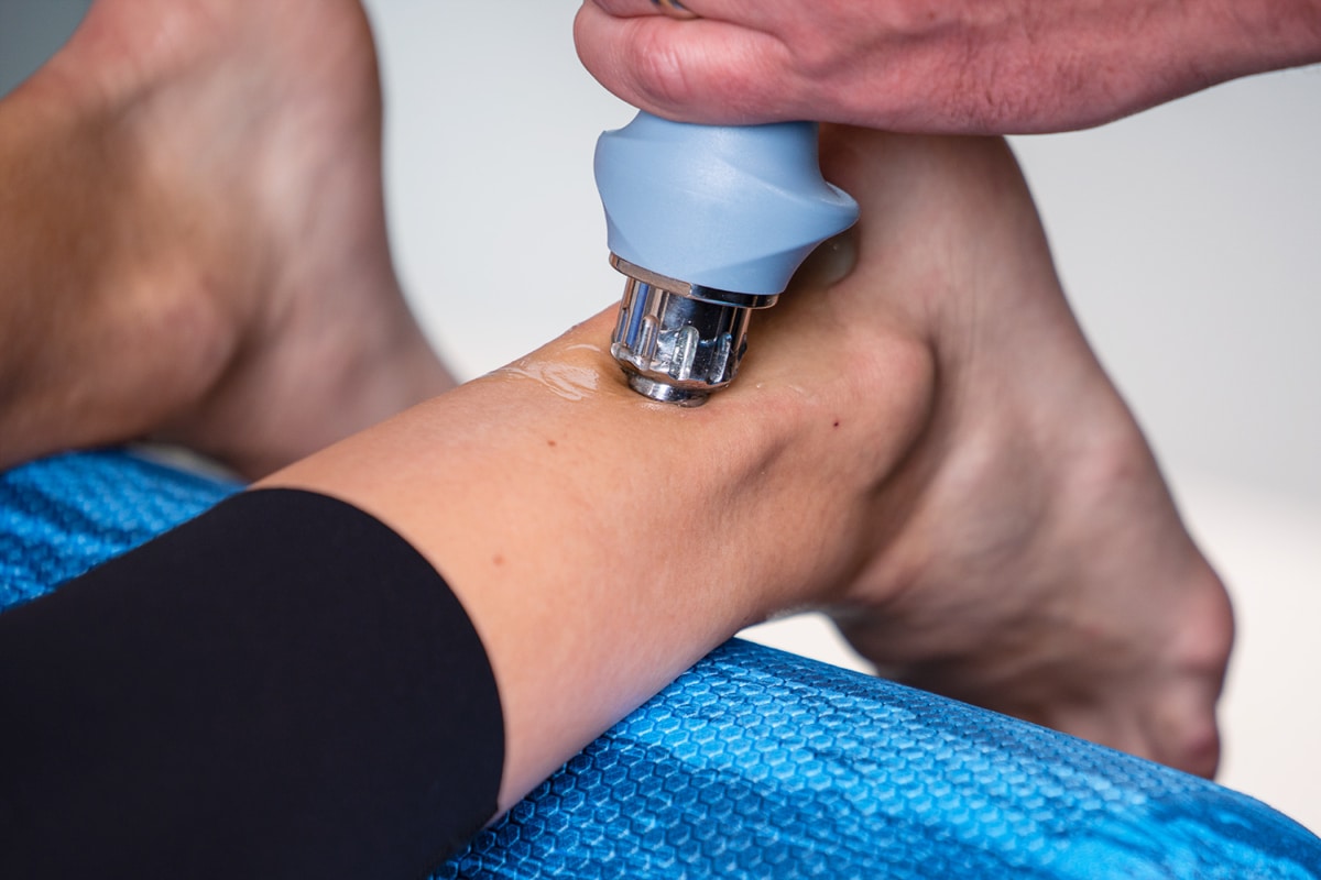 Shockwave for Achilles Tendon at Calgary Core Physioteraphy